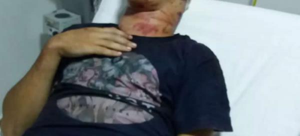 Adolescente sobrevive a tortura com golpes de martelo após se fingir de morto