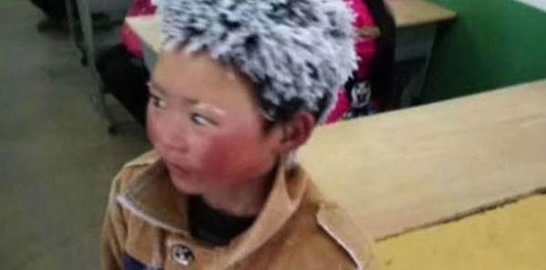 Frio implacável congela cabelo de garoto chinês e viraliza na internet