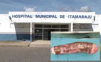 Imagem representativa do post: Homem vai parar no hospital após usar mandioca de 40 cm como brinquedo erótico